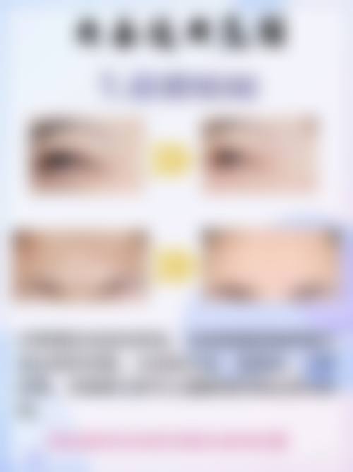 美白针可以打吗?适用与禁忌人群梳理