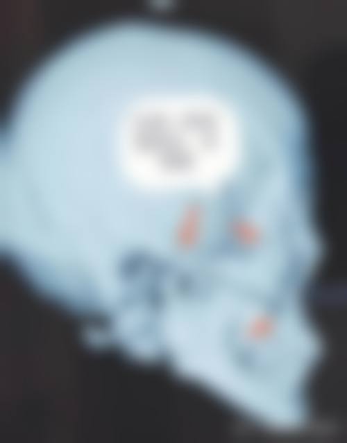 热门项目与市场参考价格