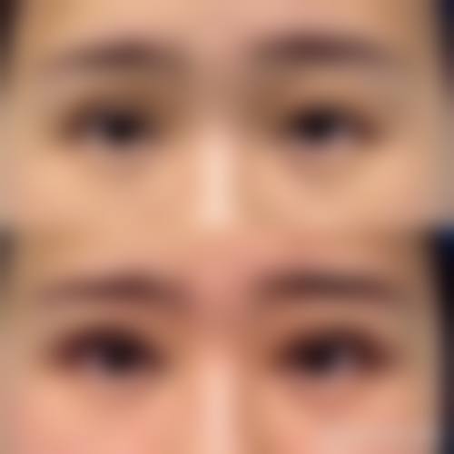 临床实例分享