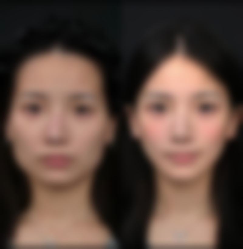 四川达州韩美整形是正规的吗?