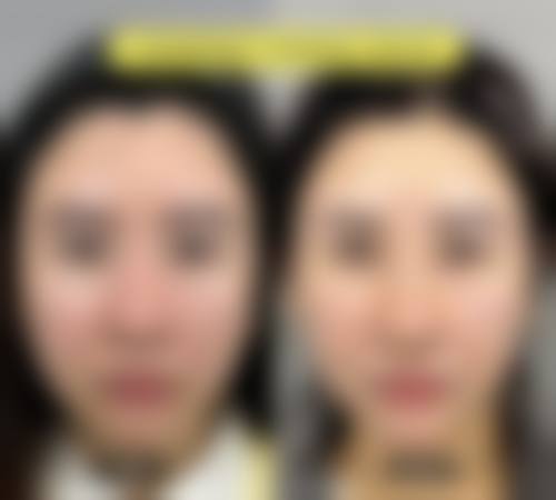 预约优惠活动