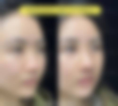 总结与预约号召