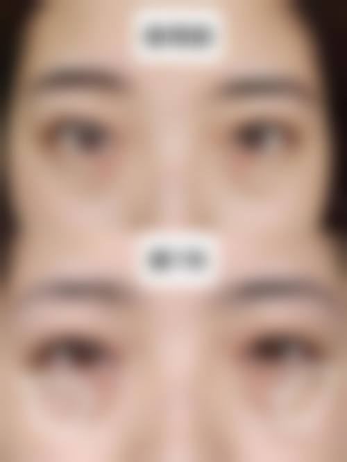 硬核设备支撑:数字化精细诊疗体系