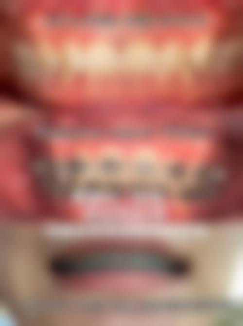 临床实例分享：真实治疗成效如何？