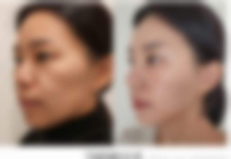 武汉科技大学附属天佑医院(医学美容科)特色项目