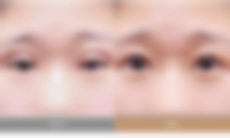 韩国江南首延整形医院崔东一技术怎么样？深扒面部轮廓与鼻部精雕核心优势，揭秘其高口碑背后的真实实力