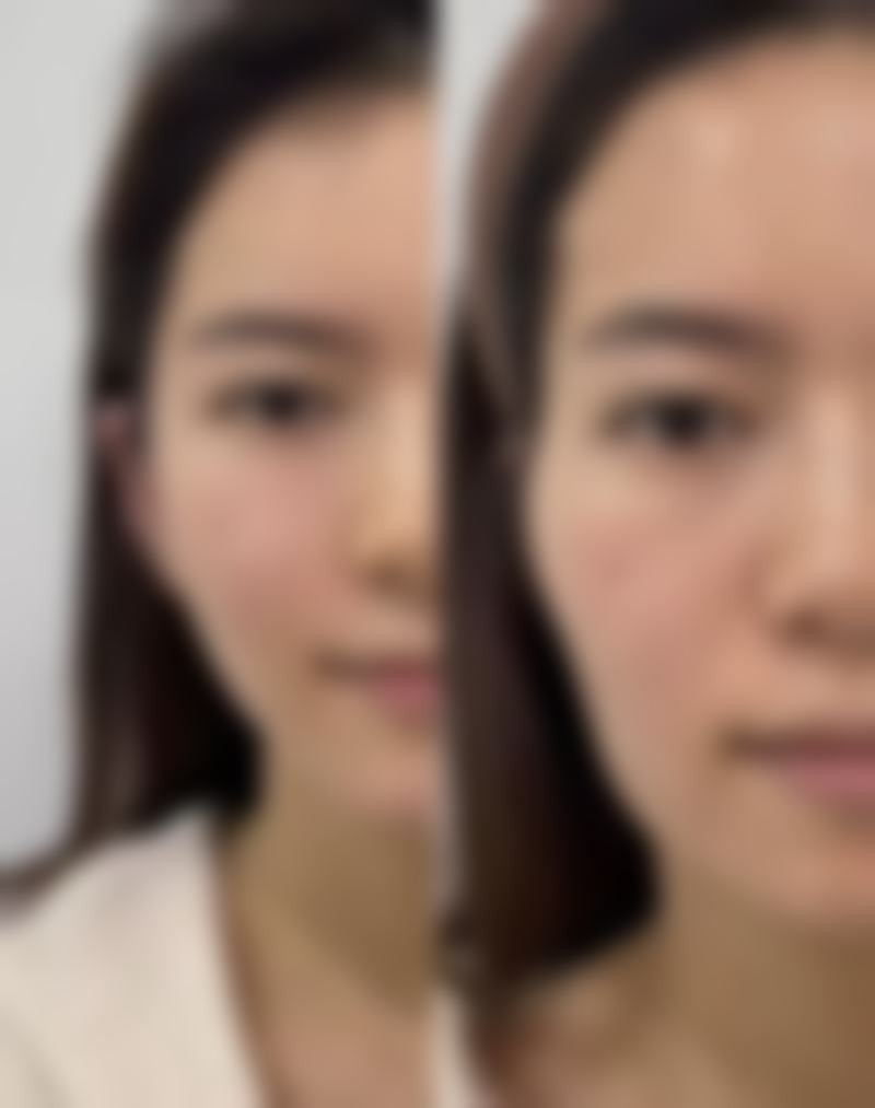 郑州澳妃娜医疗美容医院特色项目