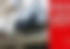 【紧致塑形】面部吸脂|下颌缘 轮廓清晰:精细塑美,自然流畅
