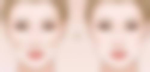 方脸瘦了是什么样子?真人改善实例参考