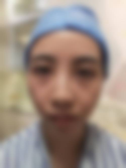 FAQ:关于北京金凤凰整形美容医院高淑芳