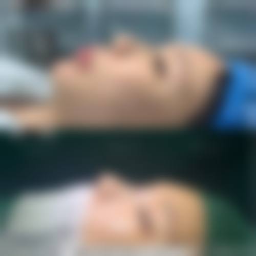 厦门碧莲盛植发医疗美容门诊部怎么预约挂号?