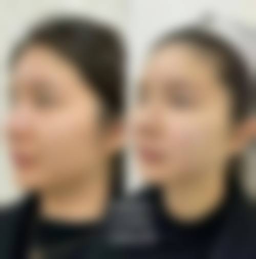 西安逆时光医疗美容门诊部参考价格表