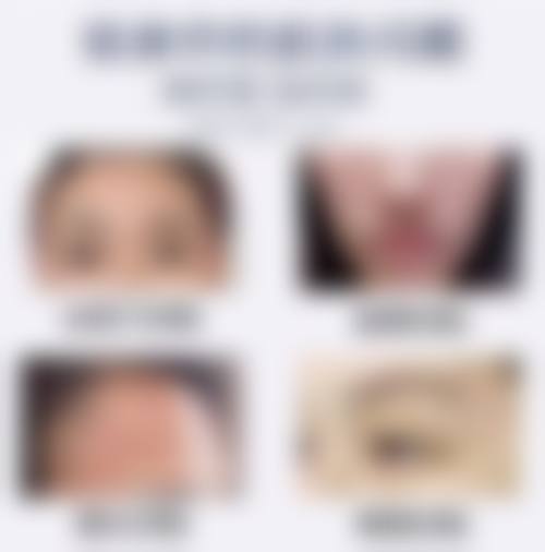 FAQ常见问题解答,消除您的末尾顾虑