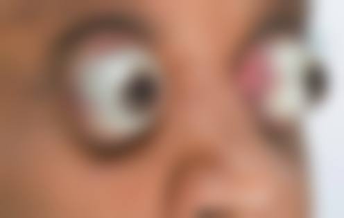 患者真实评价柳州市红十字会医院眼科