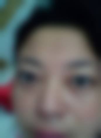 诊疗特色总结:温州市人民医院眼科刘芙蓉的服务理念