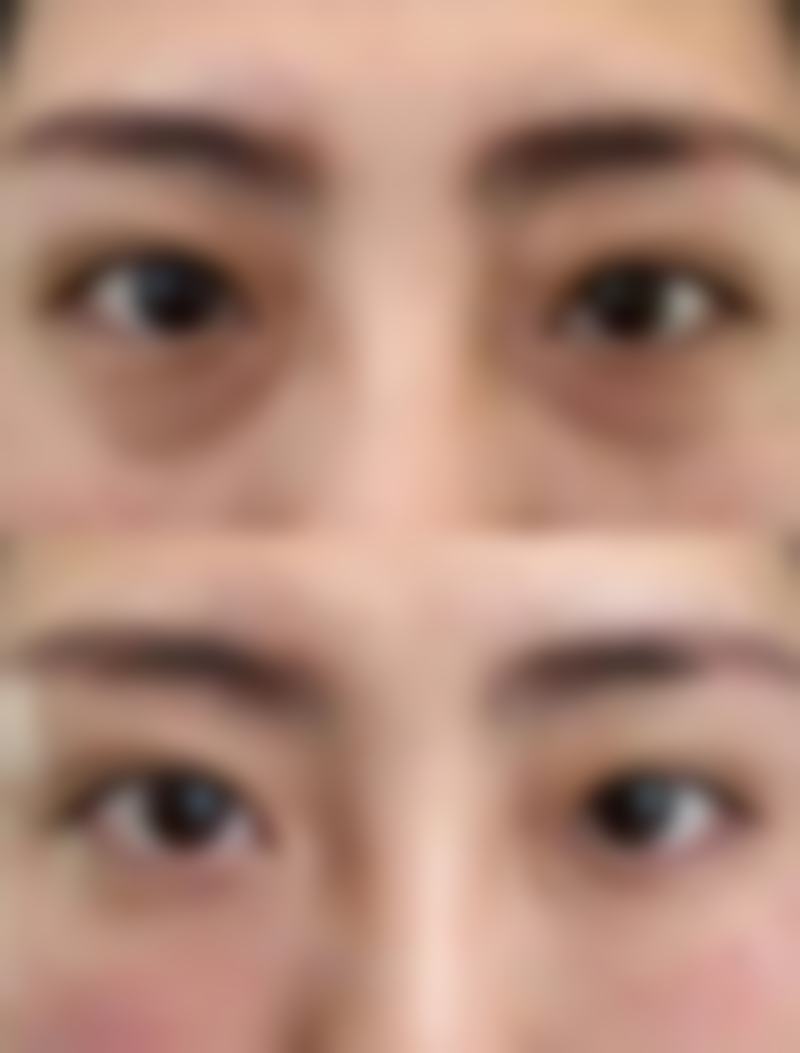 方脸脸瘦以后会不会更方?这些注意点要记牢