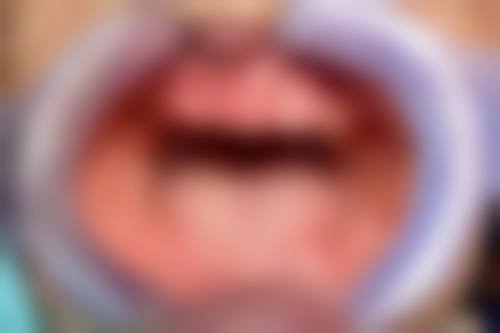 总结与预约号召
