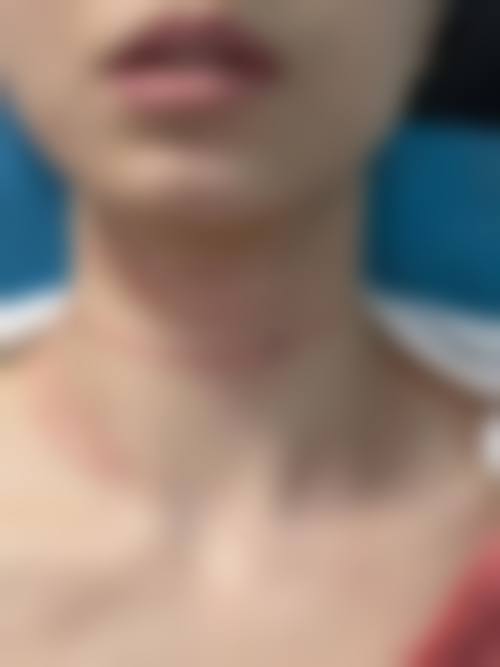 患者真实评价