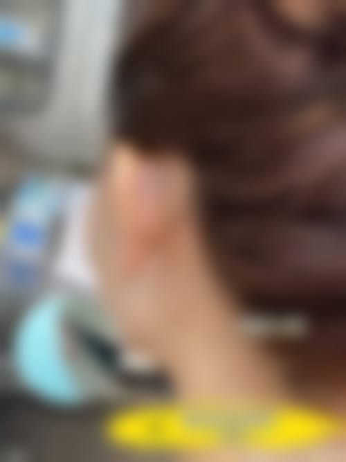 临床实例分享