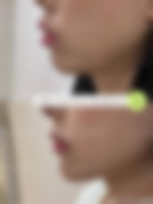 价格明细与优惠活动详情