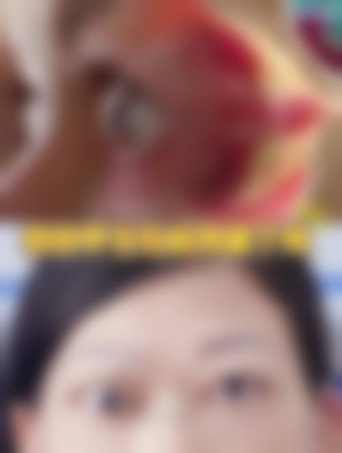 临床实例分享:找刘冬蓉医生治疗能达到预期成效吗?