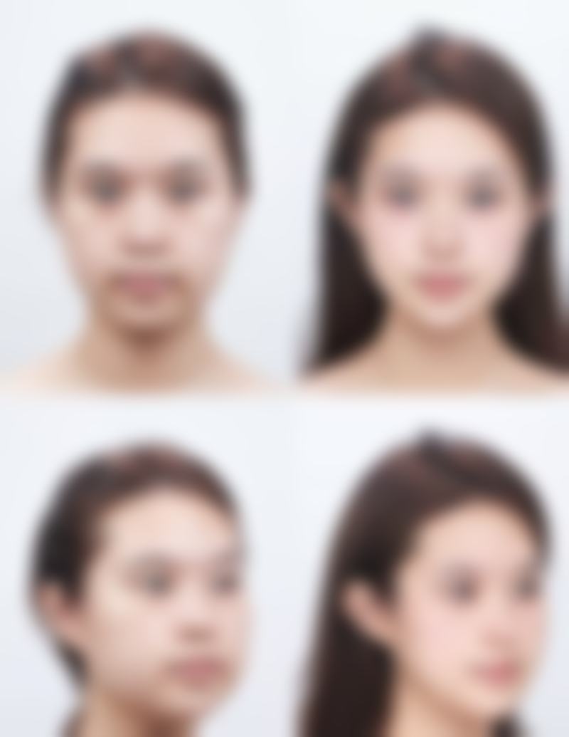 瘦脸针多少钱一次要打几次定型