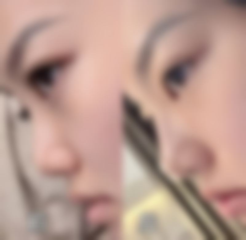 石河子市人民医院整形美容科特色项目
