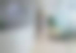 深圳联合丽格医美黄金舒玛吉（美国进口不限发数）8800元起 正版可验无隐形消费 轻松解决25+初老松弛问题