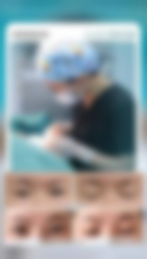临床实例分享:真实蜕变见证实力
