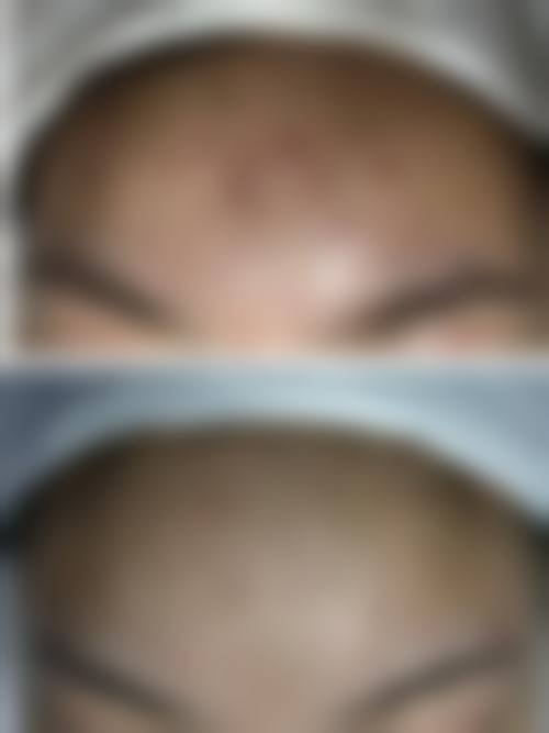 预约优惠活动:限时补贴不容错过