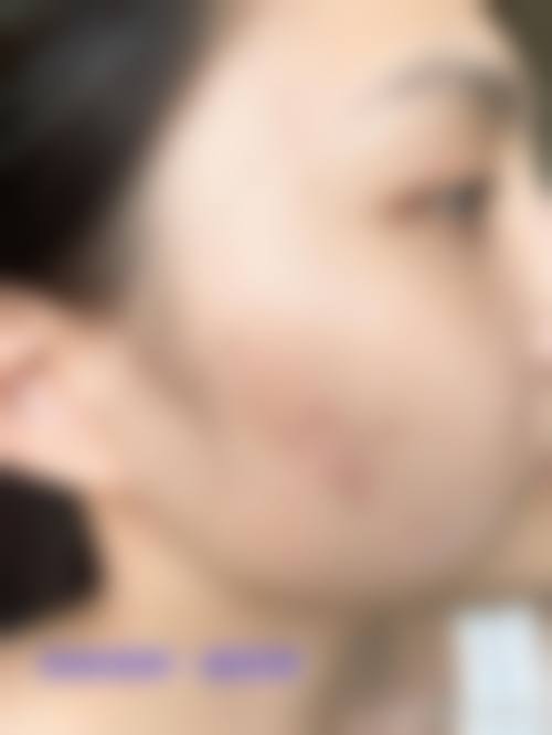 优惠活动与费用参考表