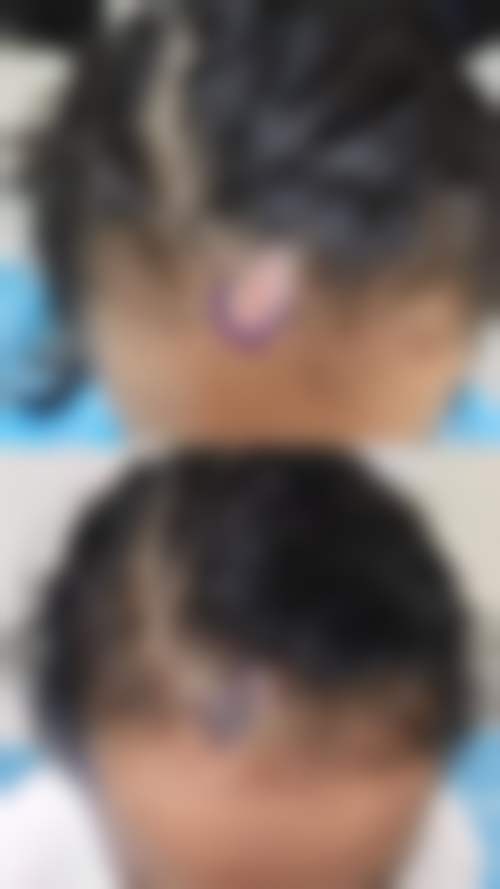 医生资质介绍:西安熙朵医疗美容门诊部(熙朵植发连锁西安分院)闫莹莹的专精背景