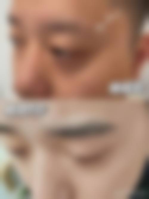 擅长项目详解:精细定制个性化方案