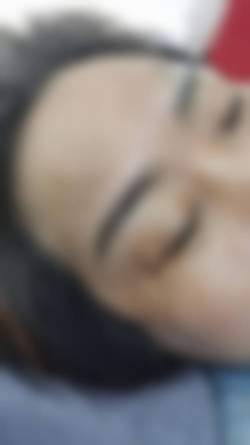 临床实例分享