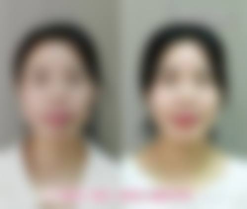 FAQ:铜陵黄雷中医美容诊所刘育风常见问题