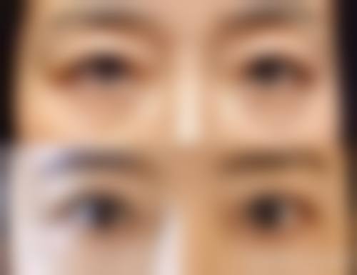 临床实例分享