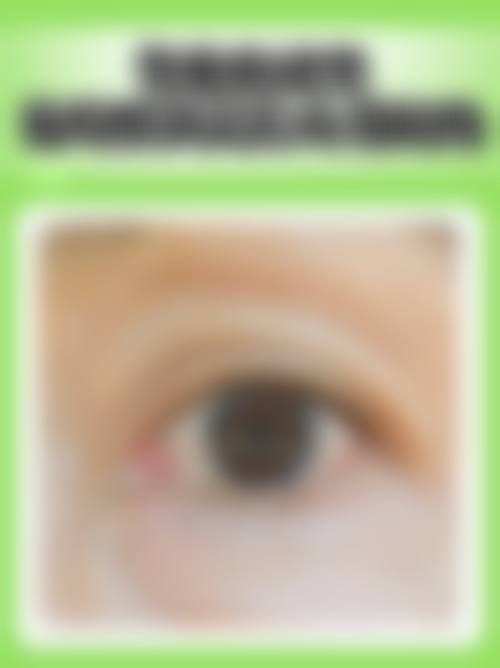 擅长项目详解:精细解决眼部难题
