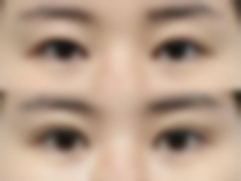 西安微美小颜医疗美容诊所是正规的吗?