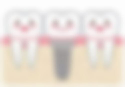 优惠活动详情