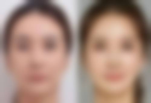 诊疗特色总结:为什么选陈思凯?