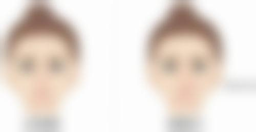 瘦脸针打了多久成效更明显?瘦脸针打完多久成效更明显?