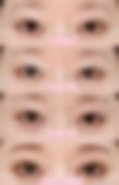 梅州曙光医疗美容医院是正规的吗?
