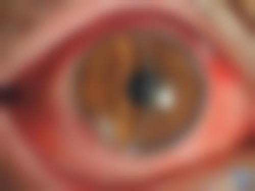 FAQ:关于宜宾市第二人民医院眼科黄懿的常见问题