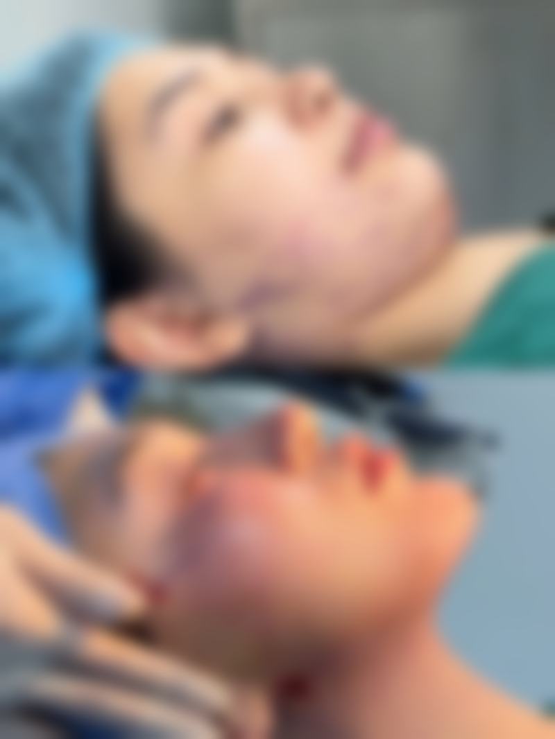 瘦脸针打一次维持多久?打瘦脸针能维持多久?打瘦脸针一次能保持多久呢?