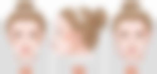种毛发种植毛发的完整流程是怎样的?