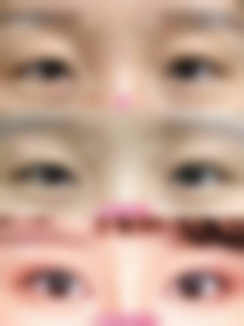 银川新面孔整形医院特色项目
