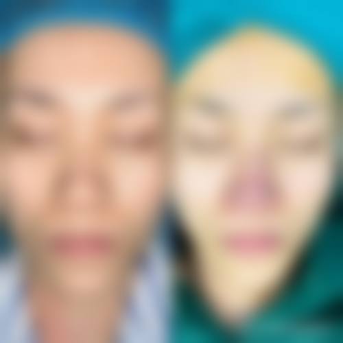 临床实例分享：王璟医生真实反馈