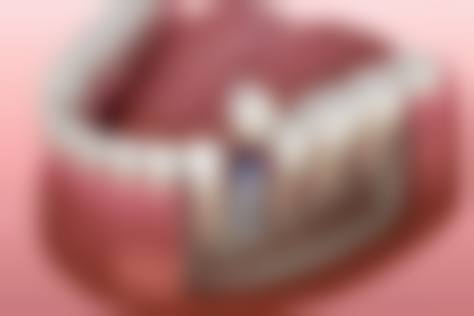 临床实例分享