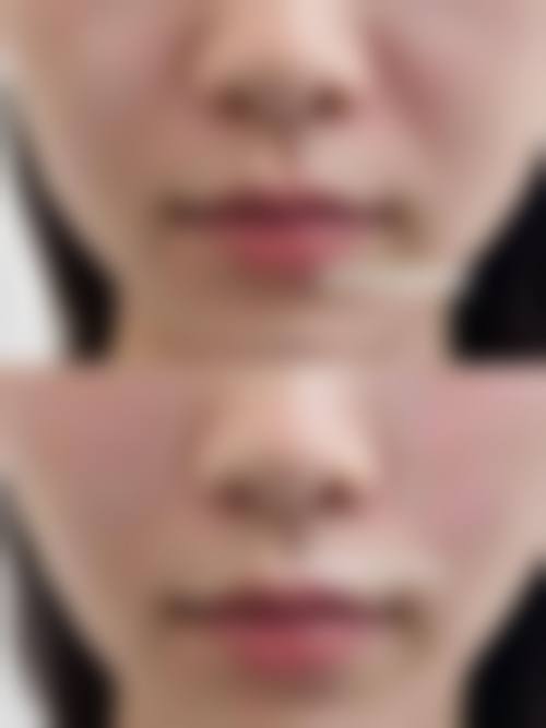 患者真实评价：王璟医生口碑见证