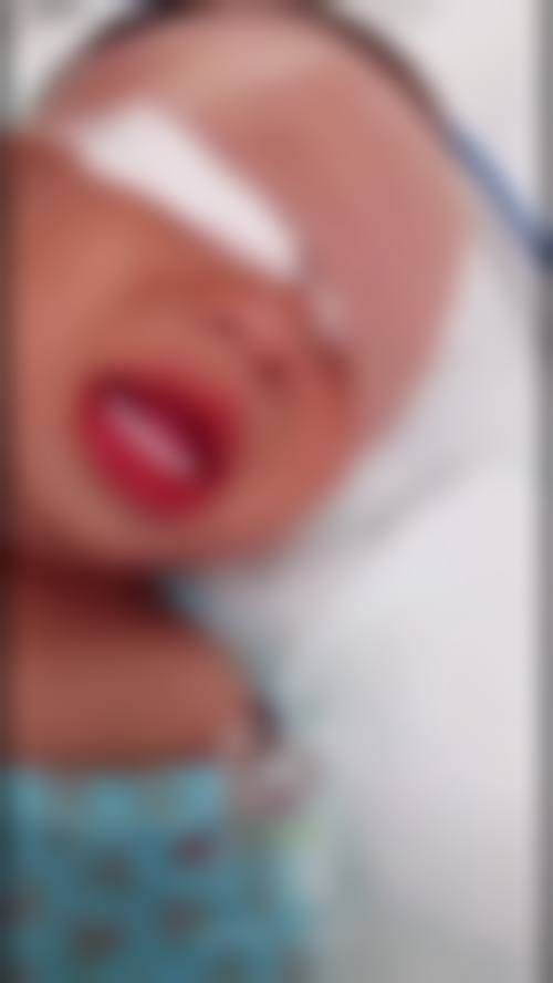 临床实例分享